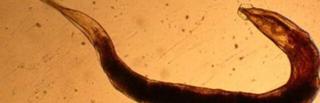 parasite of worms from the human body