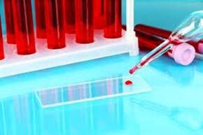 Hemus from blood drops for parasites