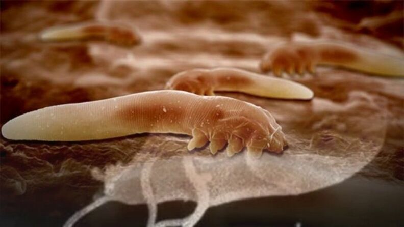 Parasites