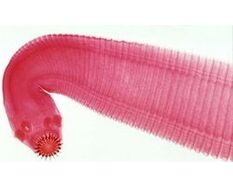 a worm parasite of the human body