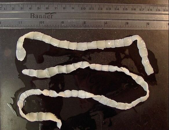 wide tapeworm of the human body