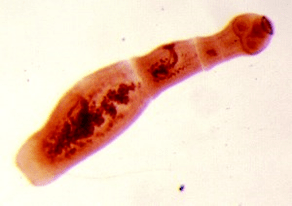 echinococcus in humans