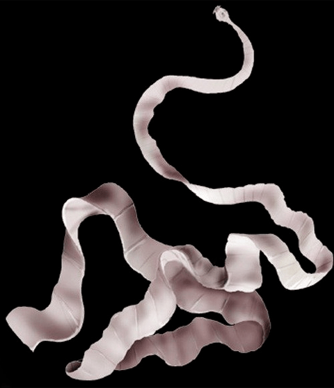 what does porcine tapeworm look like in the human body