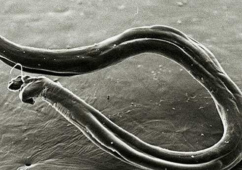 what hookworms look like in the human body