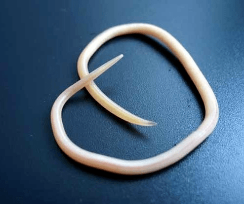 what roundworms look like